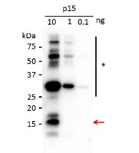 p15 [Peanut clump virus] in the group Antibodies Plant/Algal  / Plant Pathogens / Viruses at Agrisera AB (Antibodies for research) (AS16 3983)